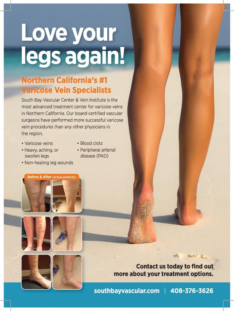 Get a leg up on varicose veins - Mayo Clinic Health System